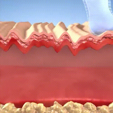 25.gif