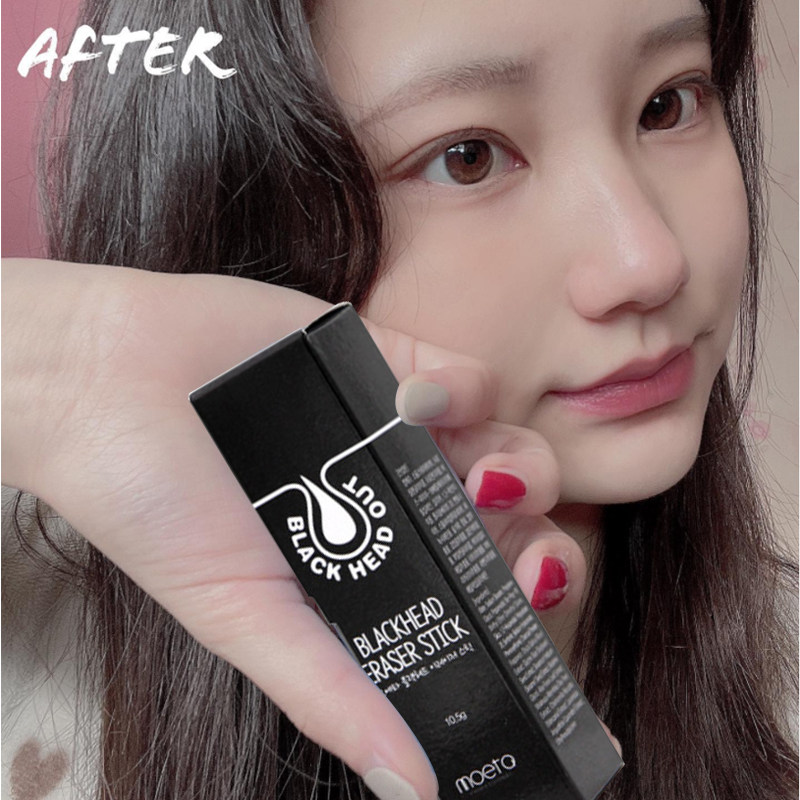 MOETA girls go blackhead stick export liquid artifact acne shrink pores closed deep cleaning students special