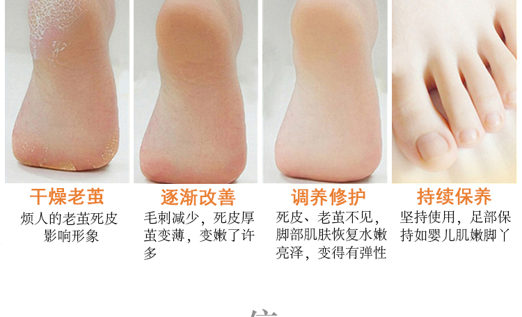 晴 tẩy tế bào chết chân tẩy da chết cũ lột da chân bàn chân chăm sóc chân màng mềm mắt cá chân kem got chan