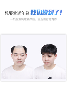 迅速提高颜值：69元包邮  眉俏 男士补发片 14cm*14cm