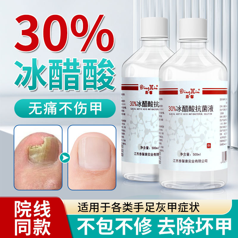 30%冰醋酸抑菌溶液百分之30抗菌剂高浓度涂剂稀释冰乙酸泡脚灰甲