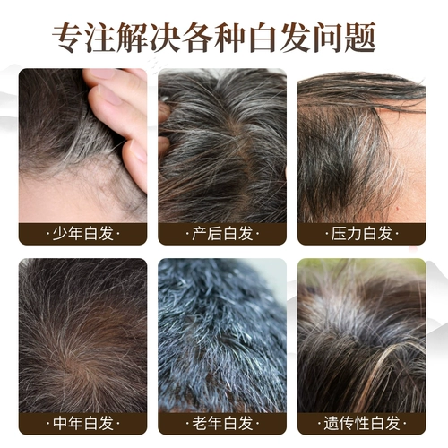 同仁堂 Лосьон для волос подходит для седых волос, эссенция, в составе Горец многоцветковый, против выпадения волос, для среднего возраста