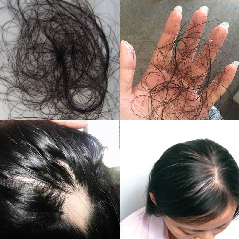 Are asians physcal different than caucasians Asian girls removing dress