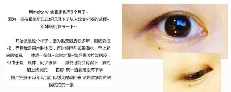 Nhật Bản Melty Wink Trang điểm mắt Kem làm săn chắc mắt Serum 17ml kem chống thâm quầng mắt