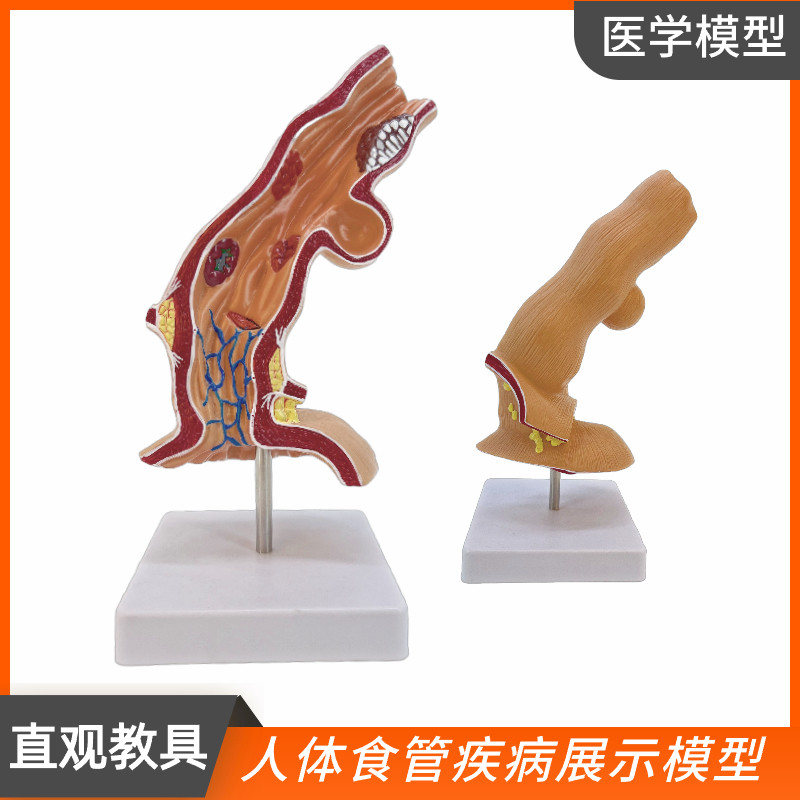 人体食管病理模型食道消化系统科室医用教学器官人体食管解剖模型