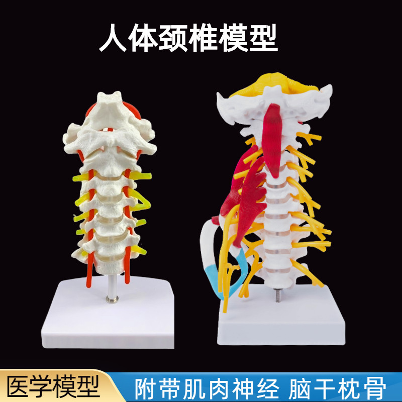 颈椎带颈动脉,后枕骨,椎间盘与神经模型,颈椎关节模型 脊柱模具