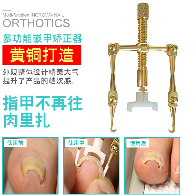 甲沟嵌甲指甲矫正器神器修剪脚趾甲专用指甲刀钳套装工具正甲贴炎