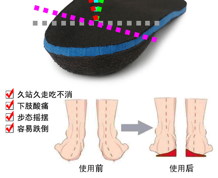 兒童扁平足矯正鞋墊寶寶內八字糾正墊X腿足外翻矯正足弓支撐鞋墊