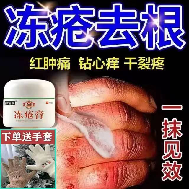 Chilblain ointment antipruritic frostbite ointment antifreeze hand face heel dry cracked redness repair cream heel anti crack anti recurrence