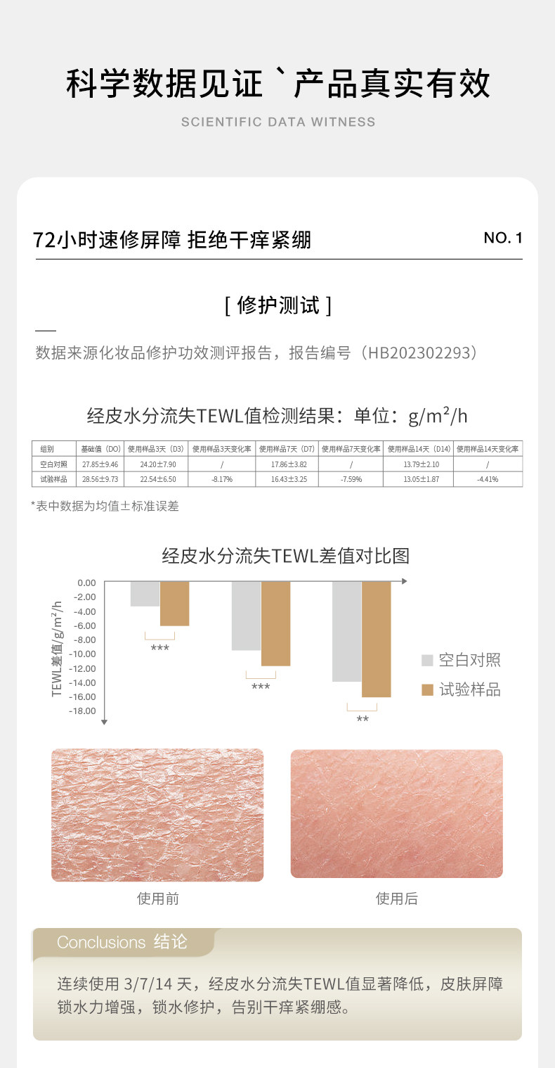 德国嫩芙橄榄妊娠油备孕妇女预防淡化肥胖纹用嫩肤妊辰身体精华油 — 37