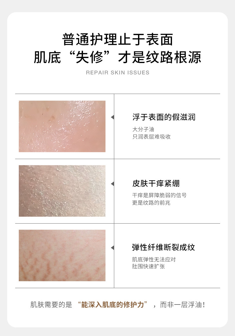 德国嫩芙橄榄妊娠油备孕妇女预防淡化肥胖纹用嫩肤妊辰身体精华油 — 15