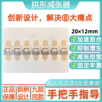 Arch bridge-shaped tensioner postoperative scar Caesarean section skin wound suture-free tightening pull-close seamer anti-widening