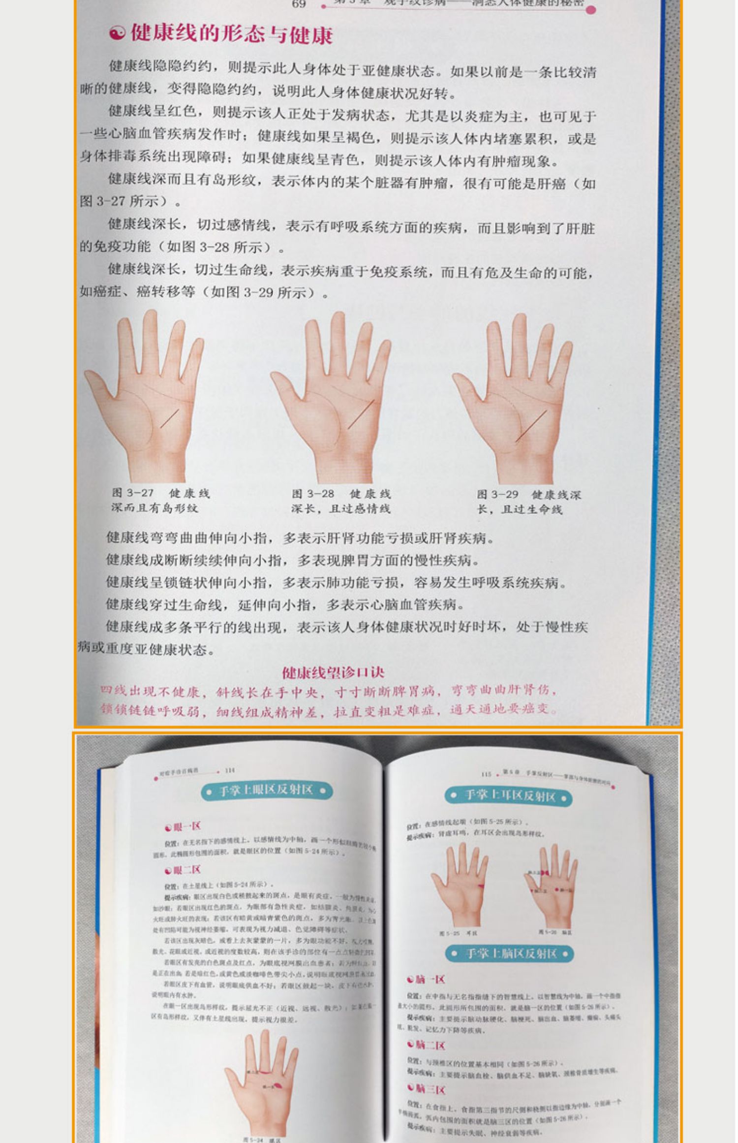 两本一学就会对症面诊 手诊百病消常见病辩症大全舌诊眼诊中医快速入门家庭医生诊断学专家指点按摩药膳食补用法歌诀养生书籍套装 虎窝淘