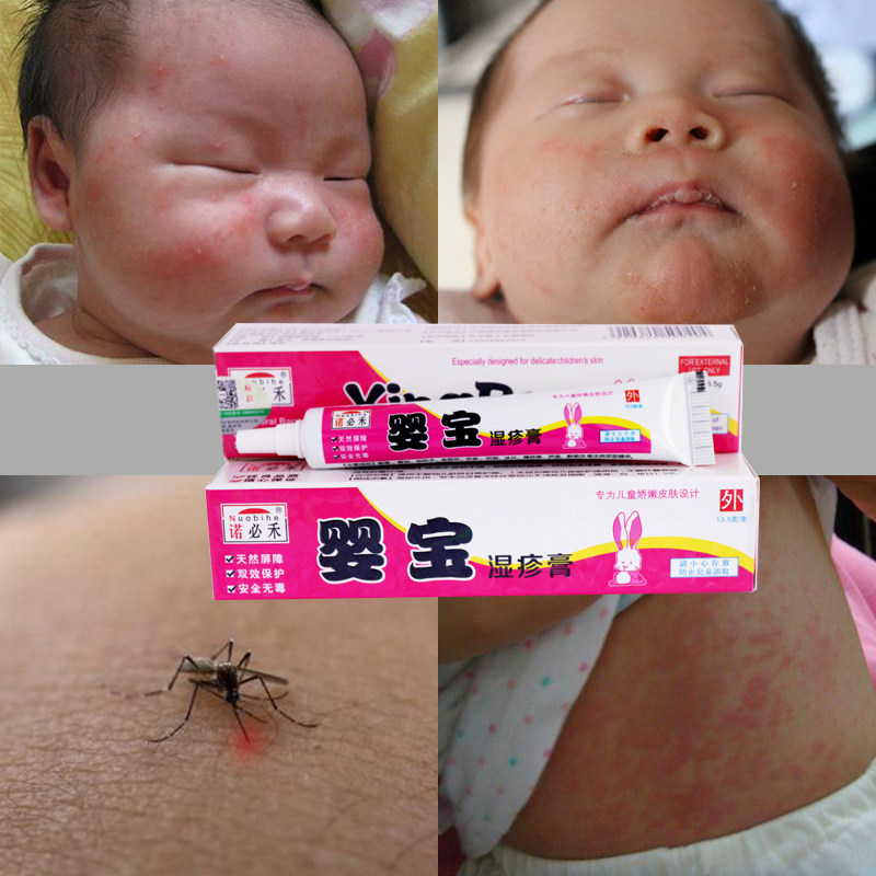 Baby baby wet cream baby baby milk tinea heat rash ointment urticaria itching children mosquito bites antibacterial cream