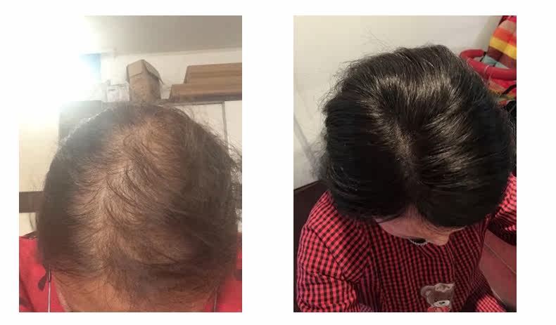 Extension cheveux - Ref 220196 Image 36