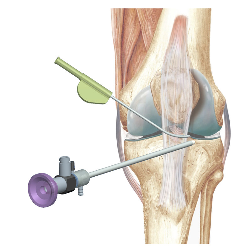 Arthroscopy Simulation Trainer Orthopedic Knee Arthroscopy Teaching Aids Knee Joint Shoulder Joint Ankle Joint