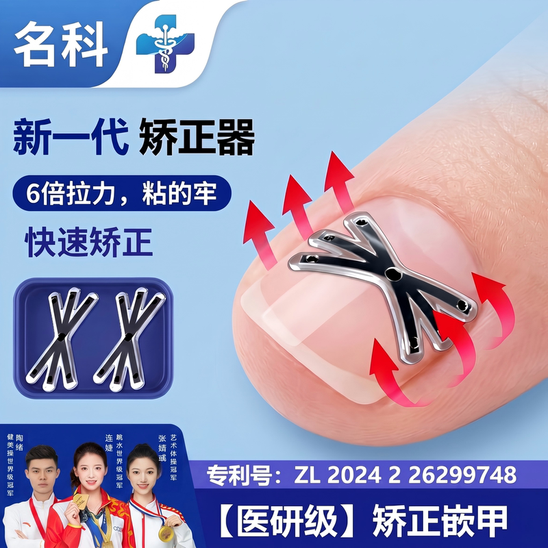 Mingke Ingrown Toenail Correction Device: Nail Correction Patch for Inflamed Ingrown Toenails, Adjusts and Shapes the Nail Shape