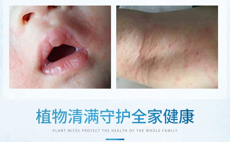 thuốc xịt côn trùng Man Ting Ngoài 螨 phun xịt thực vật phun thuốc diệt côn trùng chính hãng hộ gia đình chống bụi - Thuốc diệt côn trùng bình xịt muỗi tự vệ