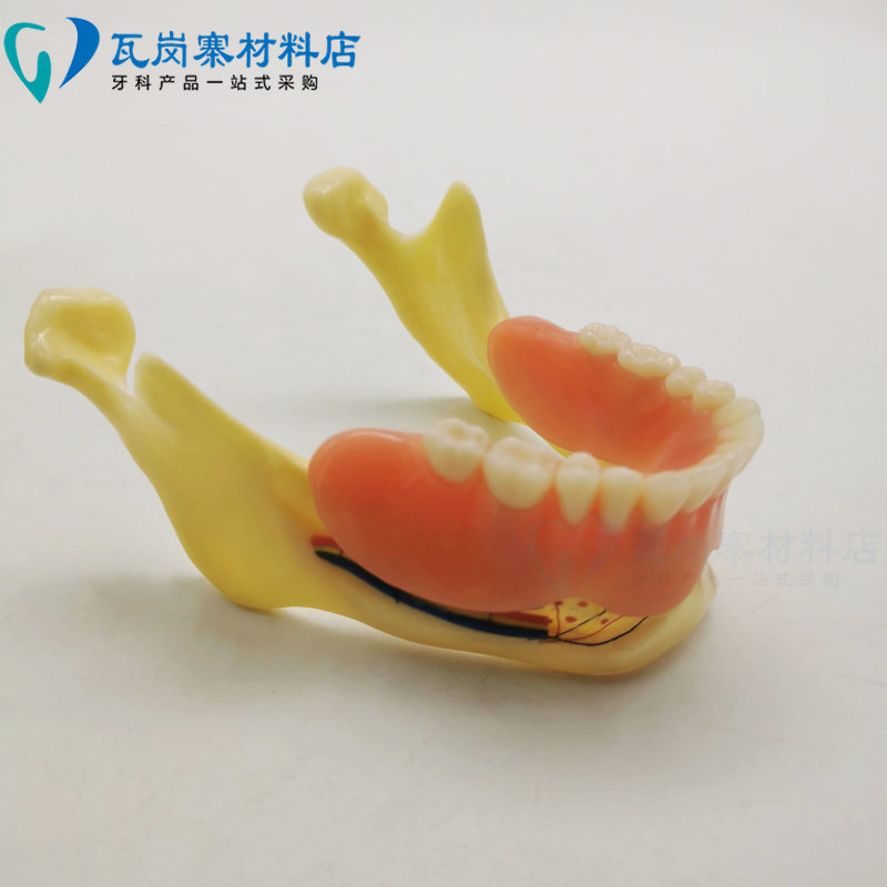 牙科口腔下颌骨带神经 义齿覆盖模型 可拆卸医患沟通讲解6005包邮