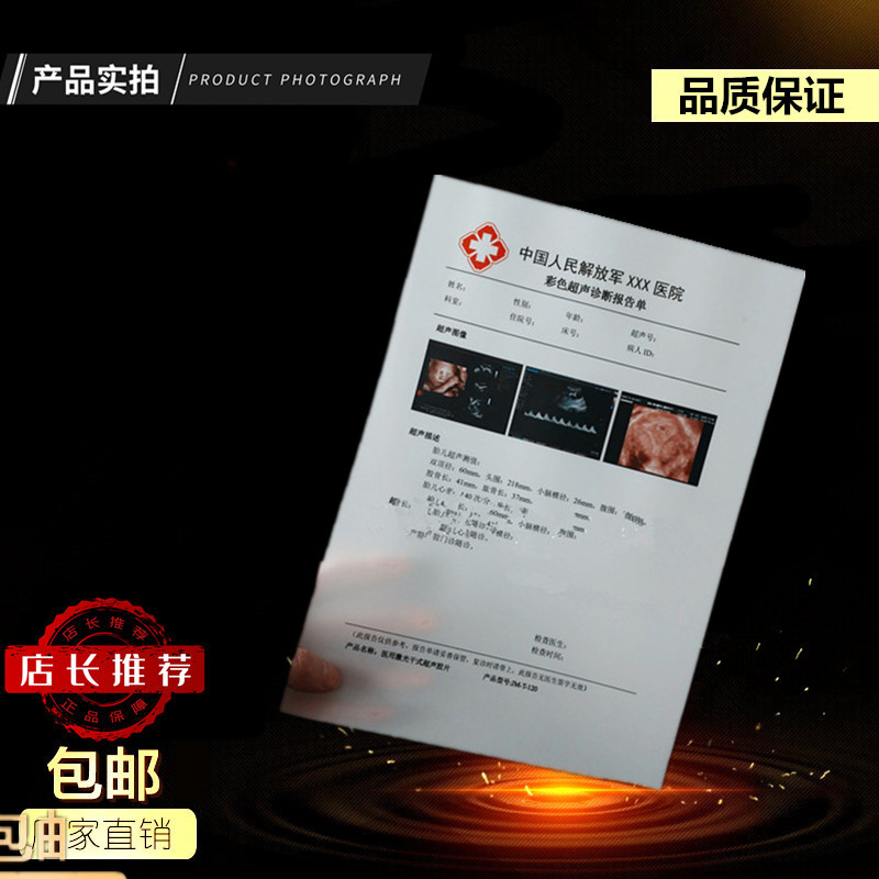 Highlight Porcelain White B5 18 2*25 7 Medical Color Printing Film B Ultrasound Medical Film (17 5S)