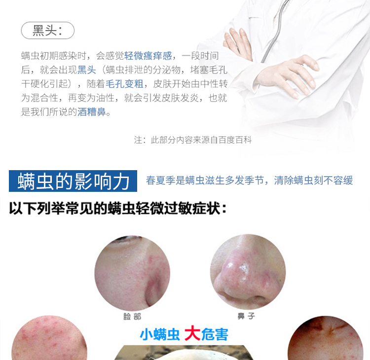 去黑头粉刺斯拉面膜 清洁脸部祛脏抖音同款 除