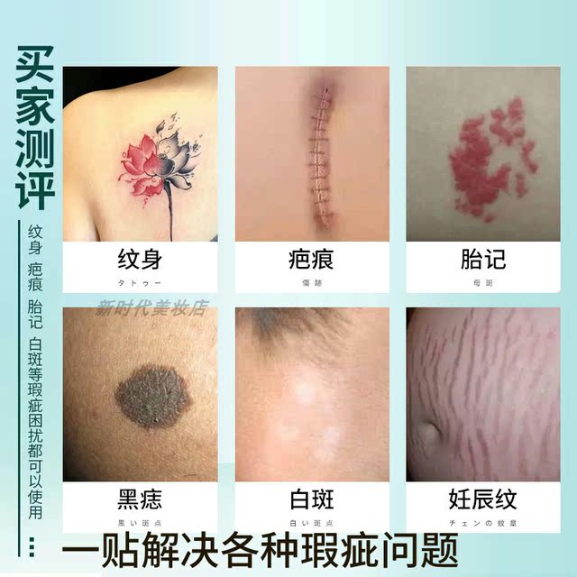 Tattoo Scar Covering Sticker Concealing Flesh Skin Color Magic Invisible Breathable Waterproof Fake Skin Covering Birthmarks and Mole Tape