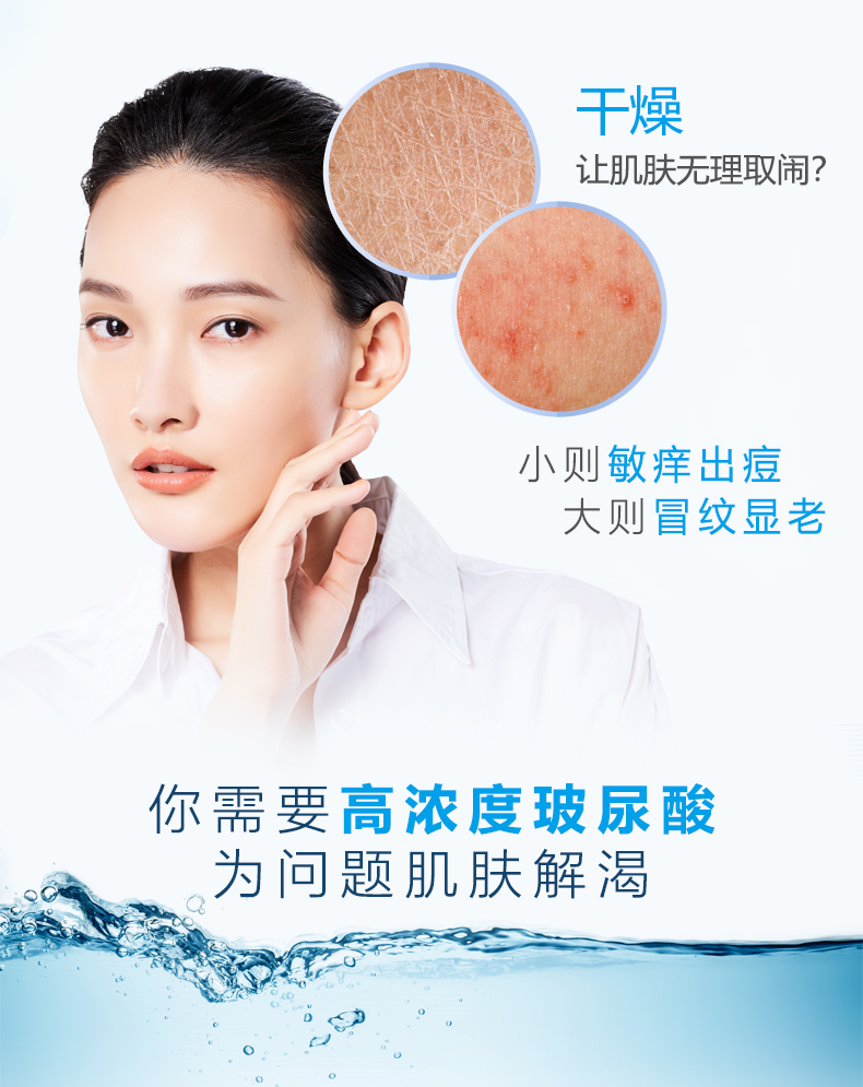 Neogence axit hyaluronic chất chiết xuất từ ​​mặt smear hyaluronic axit hydrating chất nhập khẩu từ Đài Loan tinh chất rau má 1004