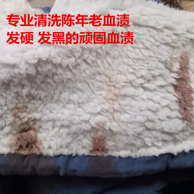 Old blood stains Clean a blood stain Remove old blood stains Stubborn blood stains Clean a hard blood stain