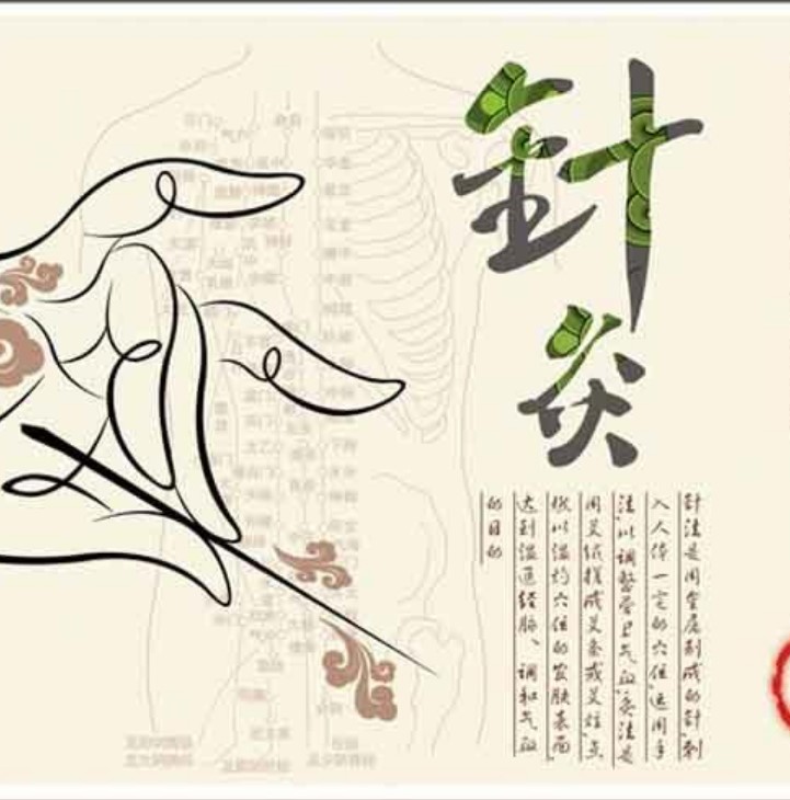 Soup Splasher in Medical Acupuncture Techniques Acupuncture Techniques Acupuncture Techniques of Acupuncture-Moxibustion and Acupuncture Law Fine Explanation of the Film Collection Network Spread