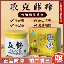 Sweat rash ointment Small blisters on the hands itchy hands peeling blisters sweat-like herpes spore rash special ointment for Kang