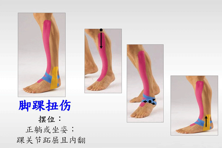 Protection sport - Ref 582440 Image 13