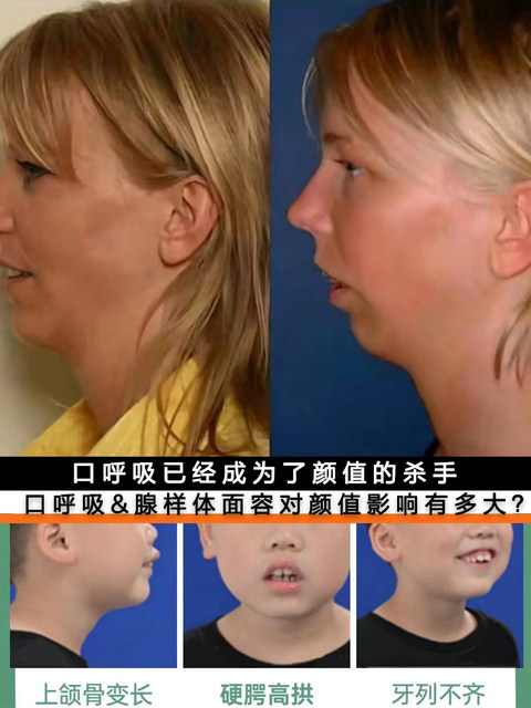 Mouth breathing correction patch for children and adults, mouth-closing patch to prevent mouth breathing and shut-up artifact, anti-open lip patch