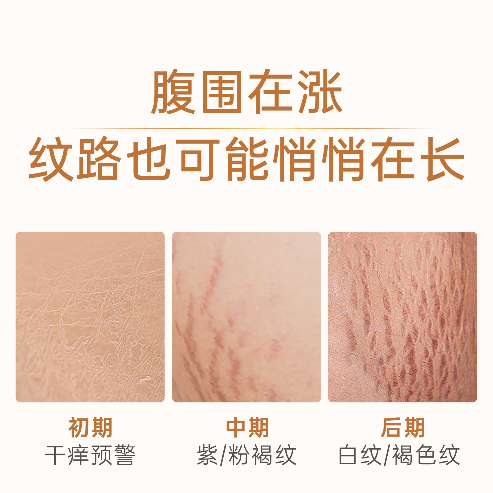 袋鼠妈妈橄榄油小金瓶妊纹路娠纹油按摩专用羊脂膏备孕舒纹路敏肌 — 9