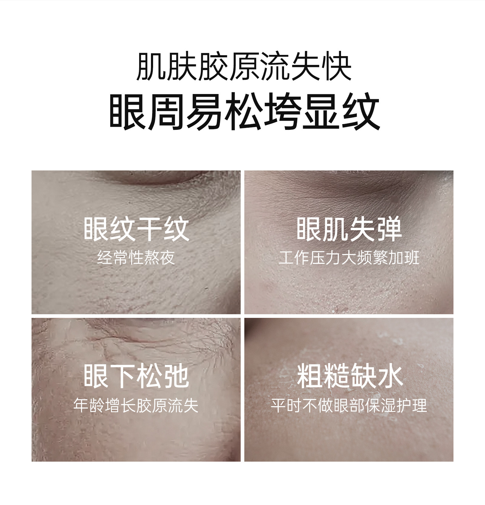 袋鼠妈妈燕窝眼霜抗皱紧致专用眼部精华滋润保湿备孕可用护肤品 — 4