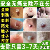 Removing fish scale moles on the feet and hands