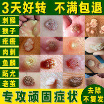 The thorn monkey removes the long meat on the hands and feet the thorn monkey meat grains remove the pimple the fish scale mole the cream point repair wart medicine artifact