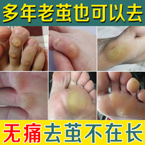 Removal of calluses foot cocoon foot thick dead skin softener callus foot pad removal cream foot small toe joint cocoon artifact