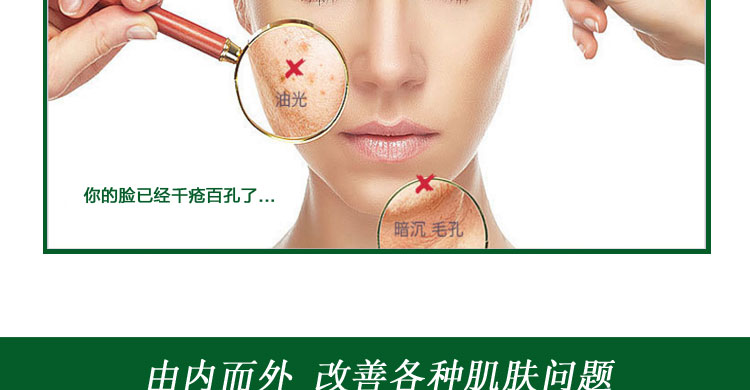 Di Zi Nuo mụn lỏng người đàn ông và phụ nữ phai mụn trứng cá marks mụn trứng cá sửa chữa làm mềm sừng mặt chất tinh chất rau má
