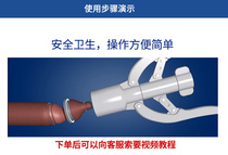 Changzhou Henry Rhino Pradrip disposable circumcision Suture Device circumcision anastomosis