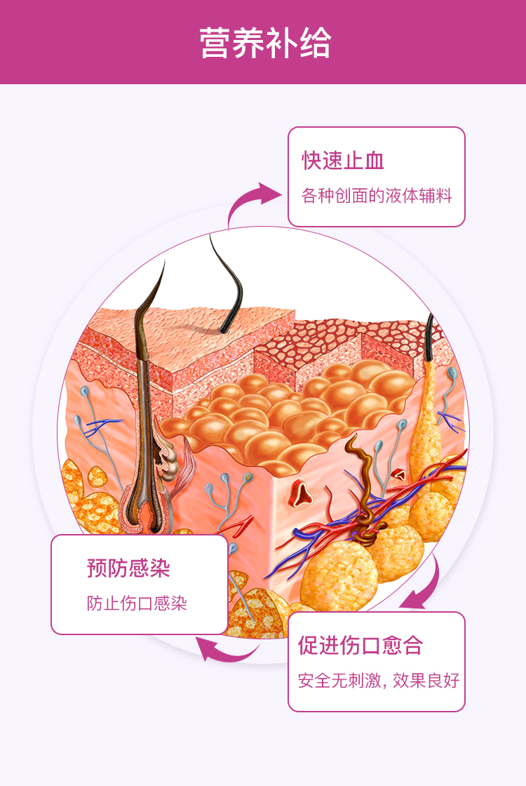 Mei Shi Meikang làm tổn thương thú cưng để giết vết thương cầm máu phun thuốc khử trùng chống nhiễm trùng chó mèo cắn vết thương chữa lành - Cat / Dog Medical Supplies 	các loại kim tiêm trong thú y	