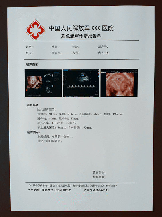 Welcome shopping (matte white) Double face printing B SUPER CT DR NUCLEAR MAGNETIC RESONANCE MEDICAL SHEET INKJET LASER BOTH