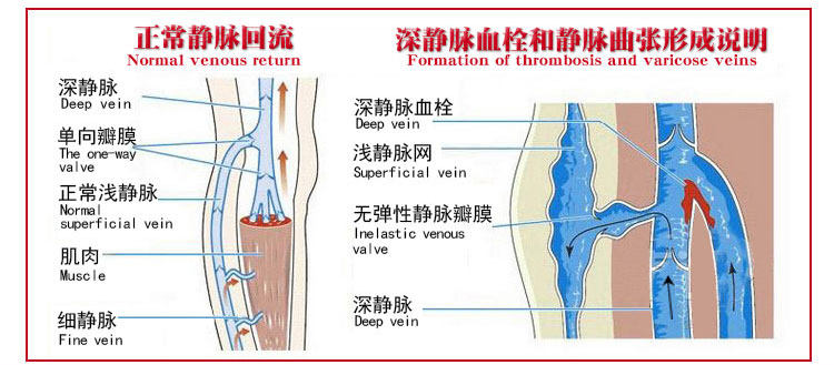 Chaussettes - collants manchon médical de veau - Ref 753919 Image 21