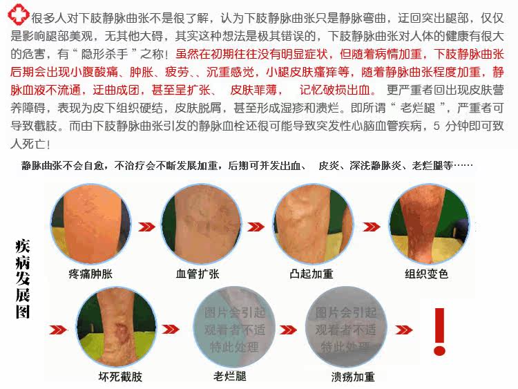 Chaussettes - collants manchon médical de veau - Ref 753919 Image 23