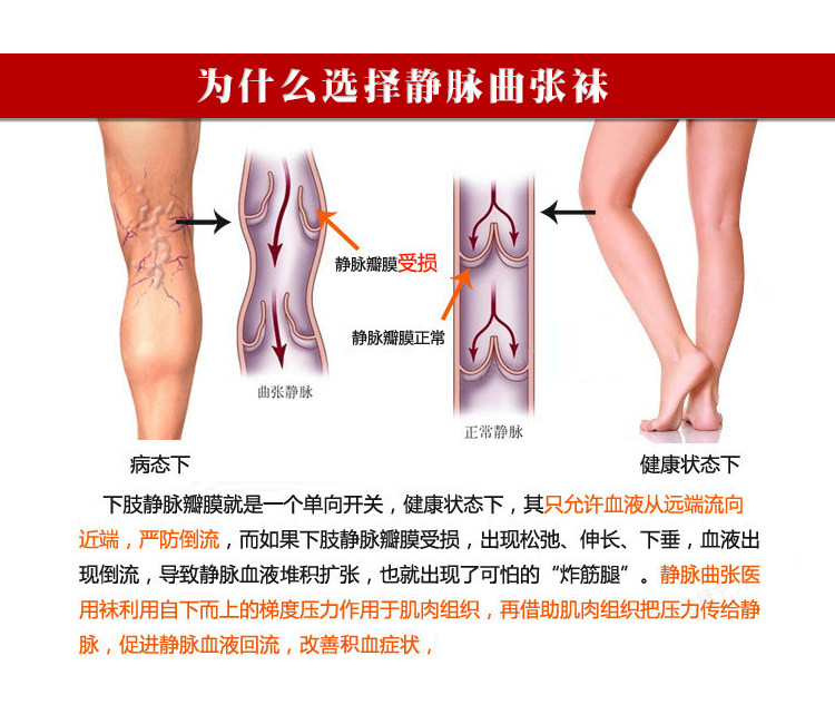 Chaussettes - collants manchon médical de veau - Ref 753919 Image 25