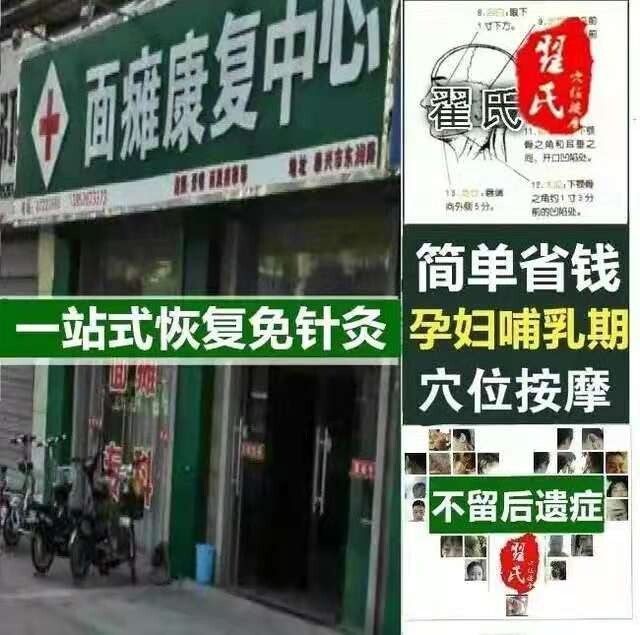 Facial Paralysis Acupuncture Ointment Patch Sequelae Rehabilitation Hot Compress Bag Face Mouth Crooked Facial Muscle Eyelid Cramps Massage Fluid Physiotherapy-Taobao