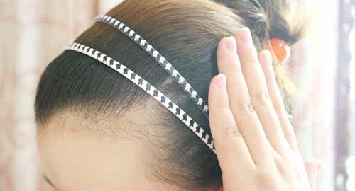 Accessoire cheveux FLOWERKIDS en autre - Ref 1203790 Image 20