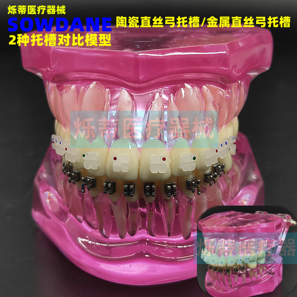 Dental Orthodontic Dental Mold 2 Types Of Trough Contrast Model Transparent Dental Mold Oral Teaching Doctor-patient Communication Model