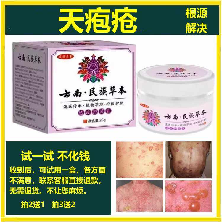 治疗天疱疮的特效药膏有哪些？如何应对不同类型的天疱疮症状？-小宠医疗用品-淘宝好物网