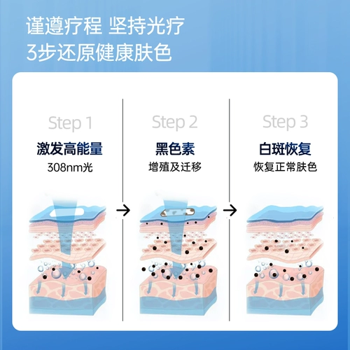 半岛 308 витилиго витилиго терапия прибор Home UVB UV Light Therape UVB лазерная псориак DI терапия свет