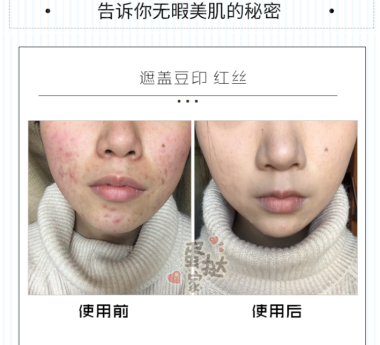 Kem đánh răng Séc 黛 Kem nền che khuyết điểm Dermacol che khuyết điểm mạnh mẽ tàn nhang che khuyết điểm fit me